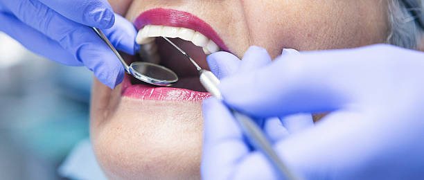 Best After-Hours Emergency Dentist in Homeland, CA